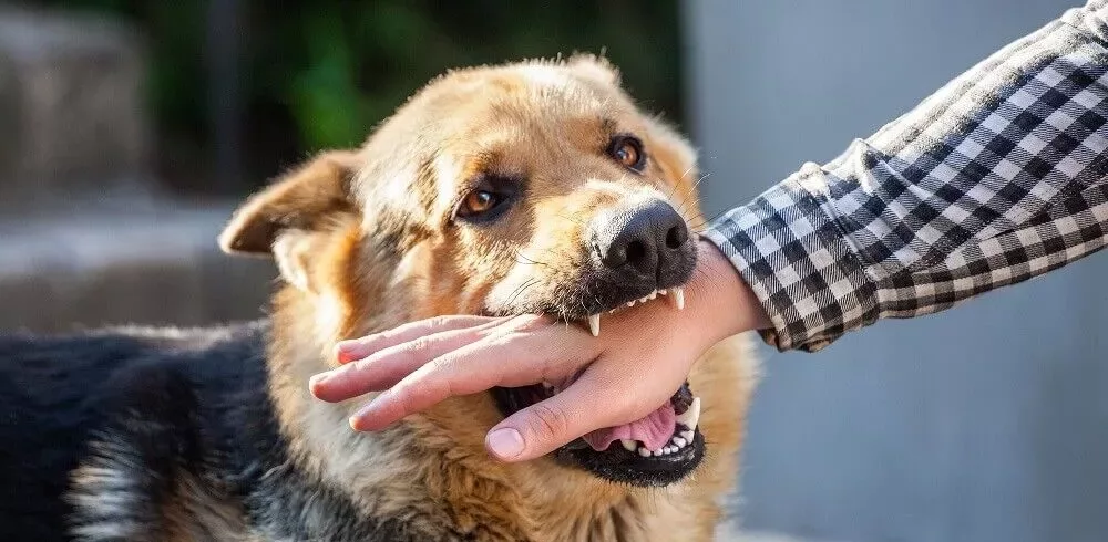 Bitten By A Dog, Do I Need A Dog Bite Lawyer